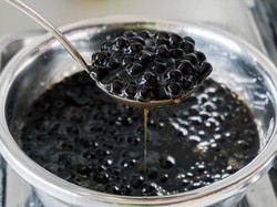 Sering Disangka Boba, Ahli Pencernaan Jelaskan Penyebab Batu Empedu