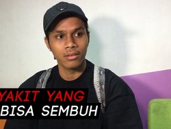 Lama Tak Muncul di Layar Kaca, Kevin Idol Ngaku Idap Psikosomatis