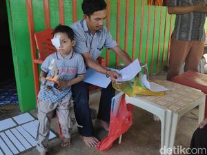 Sempat Dikira Sakit Mata Biasa, Kanker Renggut Bola Mata Bocah di Maros Sempat Dikira Sakit Mata Biasa, Kanker Renggut Bola Mata Bocah di Maros