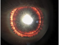 Kondisi Unik Bikin Bola Mata Pria Ini Bisa Berpendar Saat Kena Cahaya