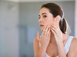 4 Cara Alami Hilangkan Jerawat Dengan Cepat