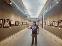 Cecep Reza Bombom Sempat Operasi Jantung Sebelum Meninggal