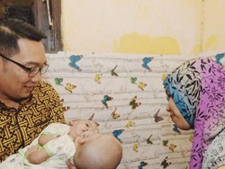 Jenguk Bayi Kembar Siam Bekasi, RK: Kita Doakan Bisa Kembali Normal