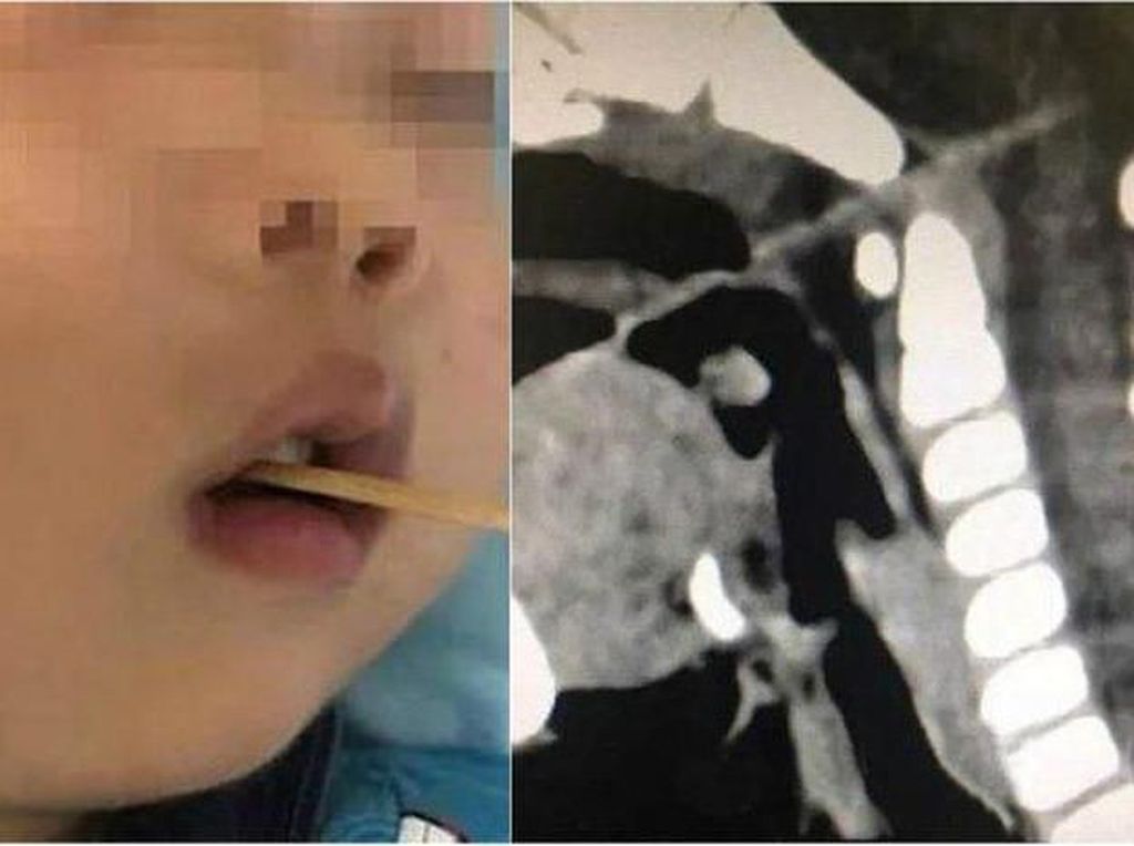 Makanan Terakhir Para Pembunuh Hingga Kejadian Tragis Kecoblos Tusuk Sate Makanan Terakhir Para Pembunuh Hingga Kejadian Tragis Kecoblos Tusuk Sate