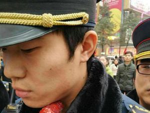 5 Kejadian Menyeramkan Soal Tusuk Sate, Menancap di Leher hingga Tewas 5 Kejadian Menyeramkan Soal Tusuk Sate, Menancap di Leher hingga Tewas