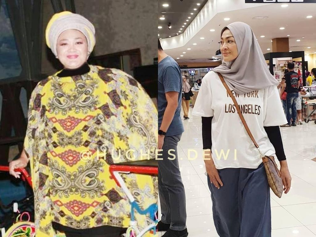Before-After Dewi Hughes yang Turun 90 Kg dengan Hipnoterapi Before-After Dewi Hughes yang Turun 90 Kg dengan Hipnoterapi