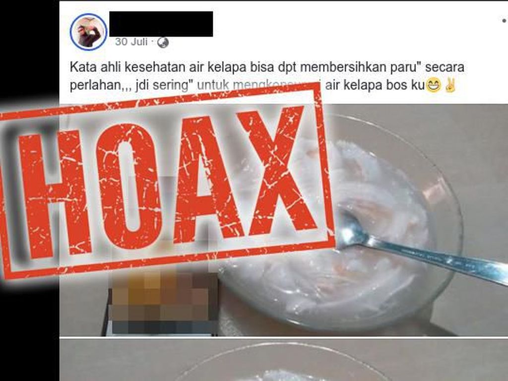 Benarkah Air Kelapa Bisa Bantu Keluarkan Dahak, Bersihkan Paru-paru? Benarkah Air Kelapa Bisa Bantu Keluarkan Dahak, Bersihkan Paru-paru?