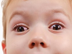 Benarkah Mata Merah pada Anak karena Sering Main HP? Begini Penjelasannya