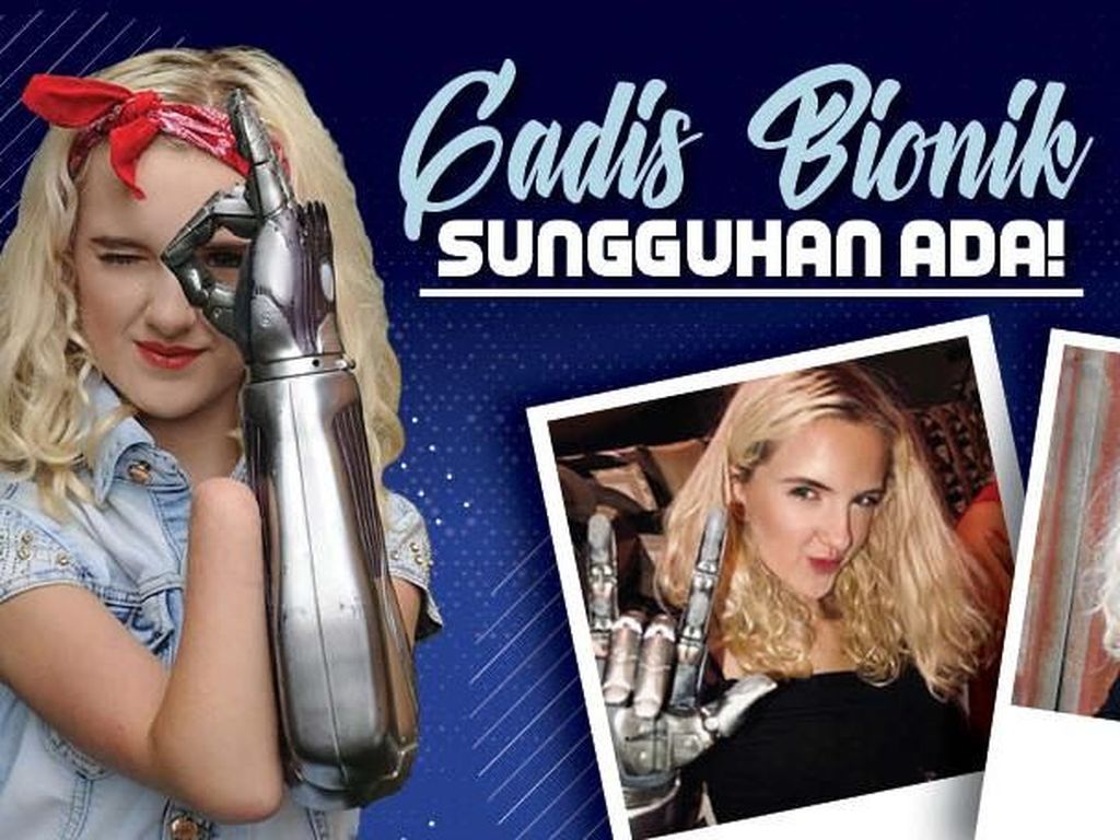 Jangan Lewatkan, Obrolan Spesial dengan Gadis Bionik Jangan Lewatkan, Obrolan Spesial dengan Gadis Bionik