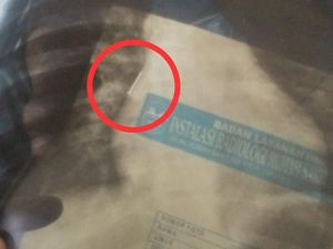 Atraksi Sulap Bocah Pangandaran Berujung Paku Tertelan Atraksi Sulap Bocah Pangandaran Berujung Paku Tertelan