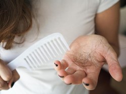 Rambut Sering Rontok? Ini Penyebab dan Cara Mengatasinya