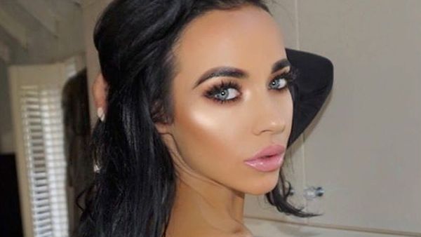 Ini Stephanie Davis, Aktris yang Ngaku Dibully karena Jidatnya