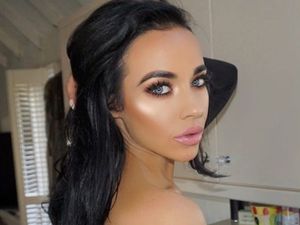 Ini Stephanie Davis, Aktris yang Ngaku Dibully karena Jidatnya