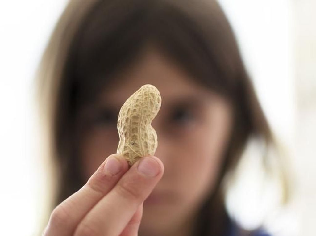 Apakah Makan Kacang Menyebabkan Jerawat? Ini Kata Dokter Apakah Makan Kacang Menyebabkan Jerawat? Ini Kata Dokter