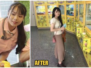 Diejek Berkaki Besar, Gadis Ini Diet Fast Food dan Bobotnya Turun 15 Kg