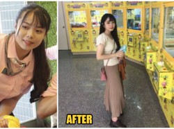 Diejek Berkaki Besar, Gadis Ini Diet Fast Food dan Bobotnya Turun 15 Kg