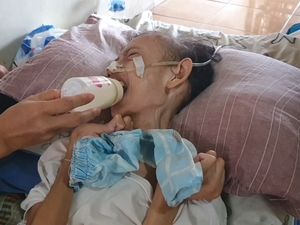 Begini Kondisi Panggah, Bocah Alami Pengeriputan Otak Begini Kondisi Panggah, Bocah Alami Pengeriputan Otak