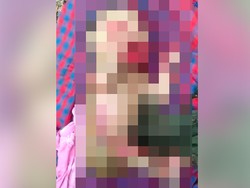 Komentar Dokter Soal Info Viral Bayi Pemakan Usus Ibu