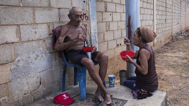 Kelaparan Venezuela Hayde Chacin and her husband Jose Calderon eat a lunch donated by neighbors in