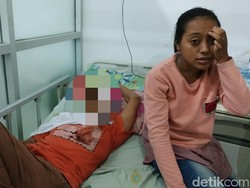 Jariyah yang Tak Bisa Lihat karena Mata Bengkak Dirujuk ke RSU dr Soetomo