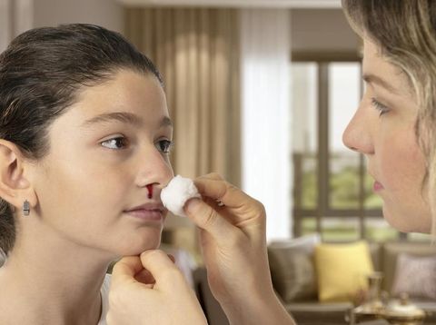 Nosebleed - Injury, Child, Nose, Blood, Care