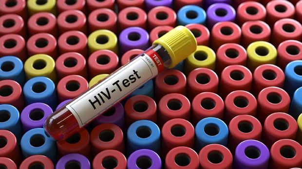 Ilustrasi test HIV