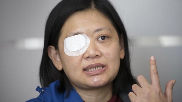 Jurnalis RI Korban Penembakan di Hong Kong Mencari Keadilan