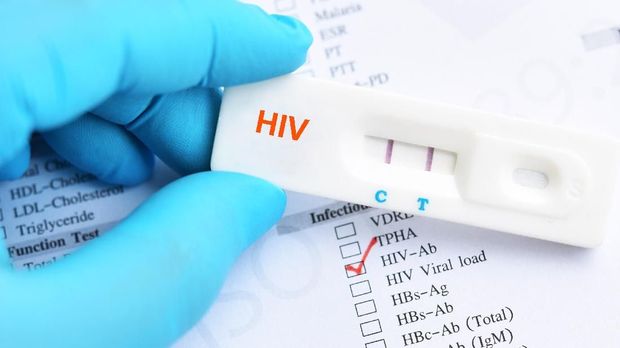 An example of an HIV test