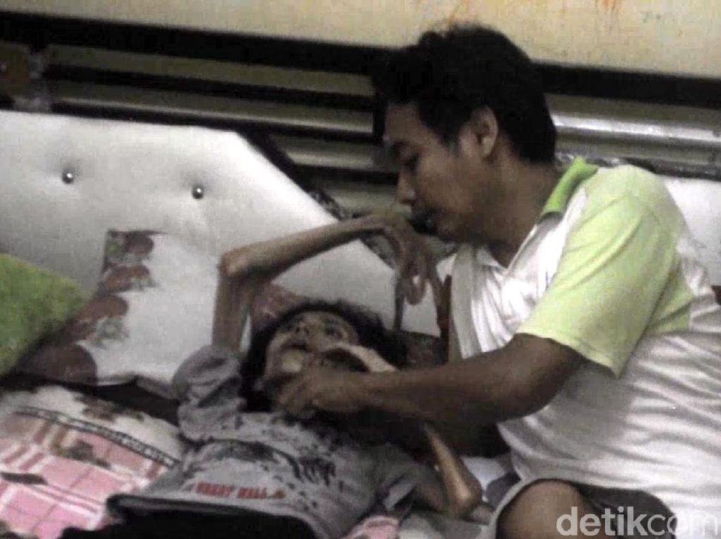 Tolong! Tubuh Wanita Ini Kering Kerontang Gegara Kanker Tolong! Tubuh Wanita Ini Kering Kerontang Gegara Kanker