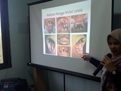 Bakti Sosial FKG UI, Periksa Kesehatan Mulut Lansia dan Pengidap Kusta