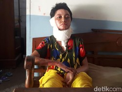 Ungkapan Traumatis Istri yang Dibakar Hidup-hidup oleh Suami