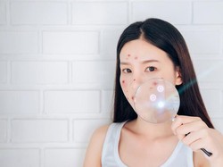 Tren Prank Pakai Filter Jerawat Viral, Bikin Pejuang Jerawat Geram