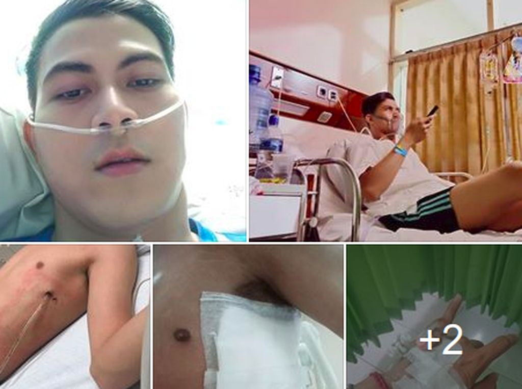 Viral Cerita Abang None, Paru-parunya Kolaps karena Rokok Viral Cerita Abang None, Paru-parunya Kolaps karena Rokok
