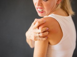 Berbagai Penyebab Alergi Kulit dan Cara Menanganinya