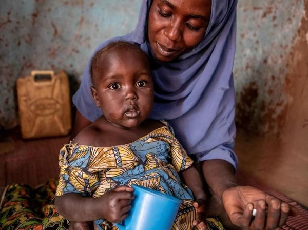 Upaya Mengobati Anak-anak Positif HIV di Uganda