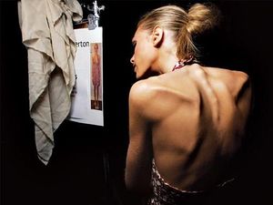 Punya Karir Cemerlang, Seleb dan Model Ini Tewas karena Gangguan Makan