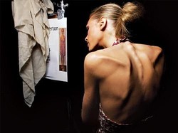 Punya Karir Cemerlang, Seleb dan Model Ini Tewas karena Gangguan Makan