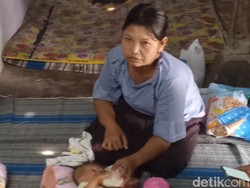 Pak Bupati, Bayi Tanpa Anus di Madiun Ini Tak Punya Biaya untuk Operasi