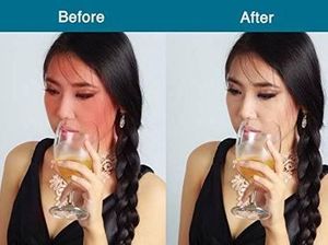 Wajah Merah Ketika Konsumsi Minuman Beralkohol Jadi Tanda Awal Alzheimer