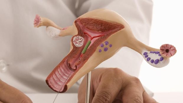 Doctor inserting an intrauterine device as an example for contraceptive method.