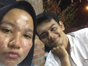 Viral Pria Tulis Pesan Menyentuh Saat Wajah Pacarnya Jerawatan Parah Viral Pria Tulis Pesan Menyentuh Saat Wajah Pacarnya Jerawatan Parah