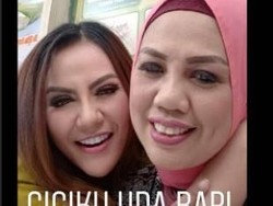 Potong Gigi Seperti Elly Sugigi Rawan Gagal, Ini Saran Dokter