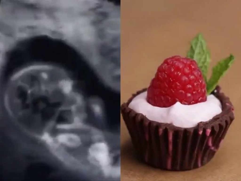 Kue Natal Ini Dikecam Netizen karena Adonannya Pakai Bayi Aborsi