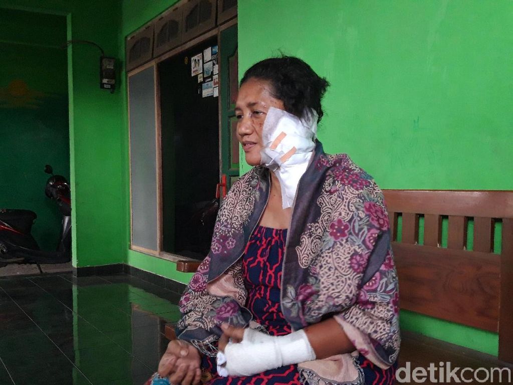 Nenek Ini Jadi Korban Penyiraman Air Keras Saat Antar Cucu Sekolah Nenek Ini Jadi Korban Penyiraman Air Keras Saat Antar Cucu Sekolah