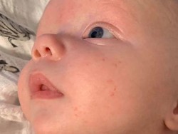 Bayi Delapan Minggu Digigit Ular di Keranjang Tempat Tidurnya