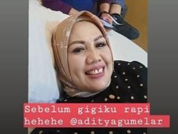 Potong Gigi Bikin Pangling, Elly Sugigi Lakukan Demi Berondong?