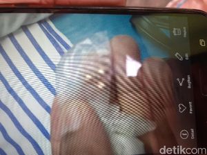 Diberondong 10 Tembakan, 2 Peluru Bersarang di Kepala Pedagang Kopi Diberondong 10 Tembakan, 2 Peluru Bersarang di Kepala Pedagang Kopi