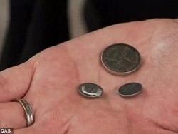 Cerita Ibu yang Anaknya Telan 6 Baterai, Hasil Rontgennya Bikin Syok