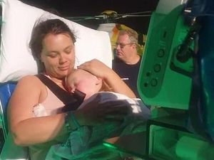 Dikira Permen, Balita Ini Hampir Meninggal Setelah Telan 20 Baterai Koin