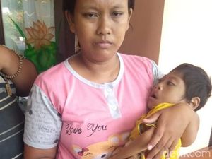 Kompleks, Bocah 7 Tahun Ini Kurang Gizi, Lumpuh dan Bibir Sumbing Kompleks, Bocah 7 Tahun Ini Kurang Gizi, Lumpuh dan Bibir Sumbing